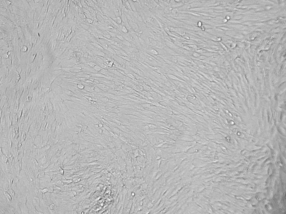 NEPA21 / Primary - Human Endometrial Stromal Cells - Viability 95 per cent